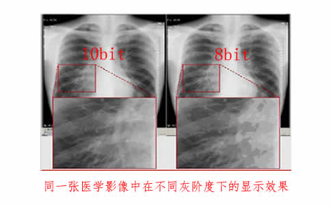 灰阶显示器使用上有什么注意点